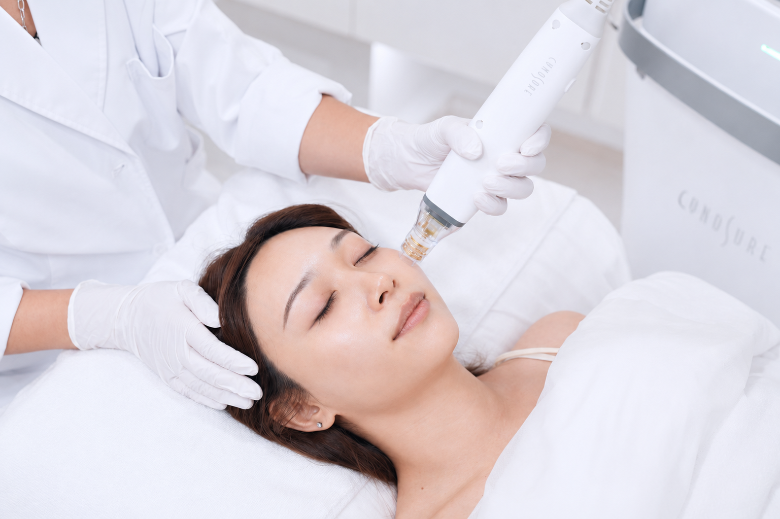 Potenza 射頻微針儀器，Cynosure 出品，可處理凹凸洞、毛孔粗大、皮膚鬆弛 