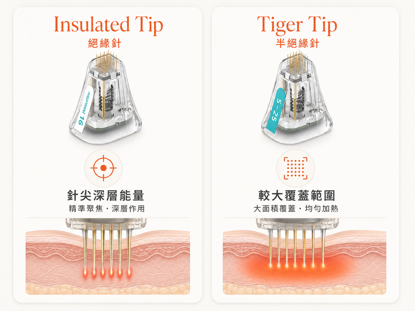 Potenza 絕緣針半絕緣 Tiger Tip 分別比較