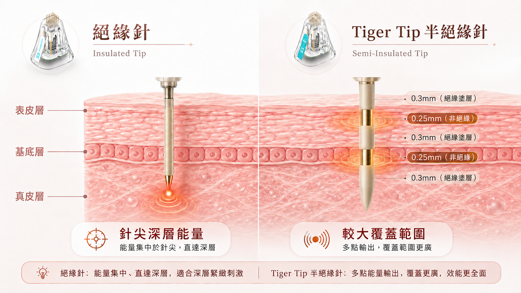 Potenza 絕緣針與半絕緣 Tiger Tip 射頻微針原理圖